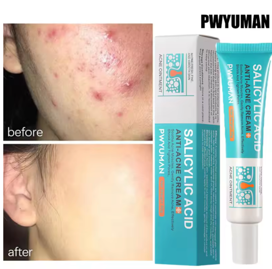 Crème Anti-Boutons Purifiante ByeByeBouton
